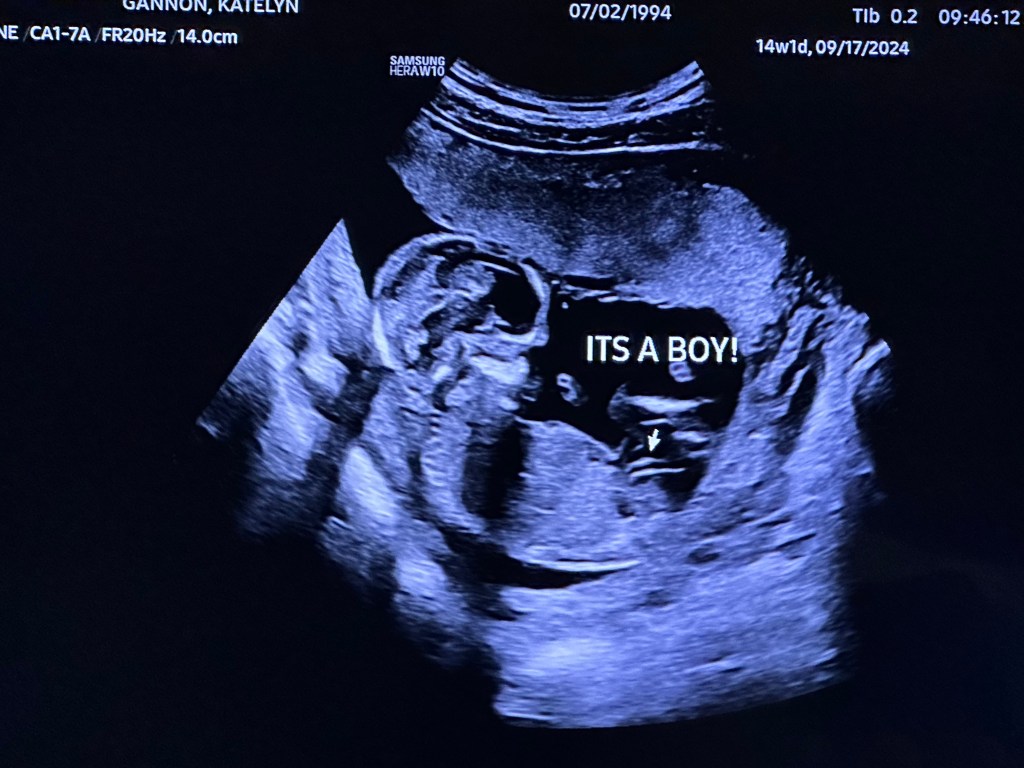 Zion’s Birth Story